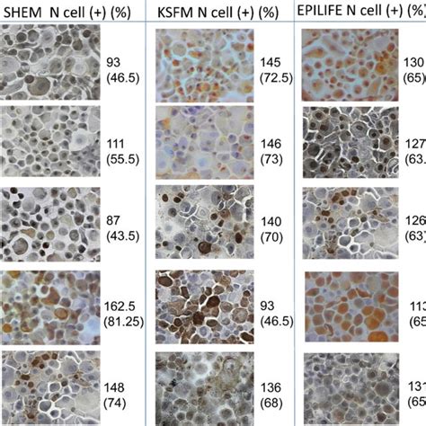 perCenTage of deviTalized ThroughouT CellS wiTh hoeChST STaining | Download Table