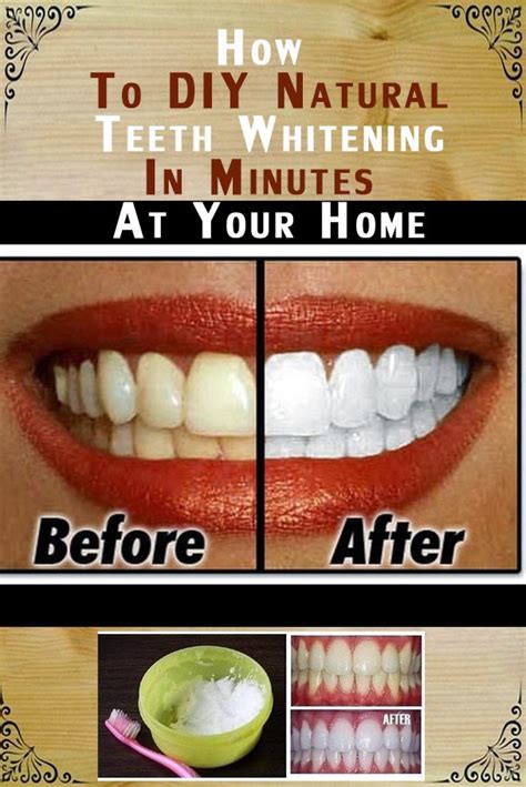 How to DIY Natural Teeth Whitening in Minutes at Your Home | Natural Tooth Whitening Ideas