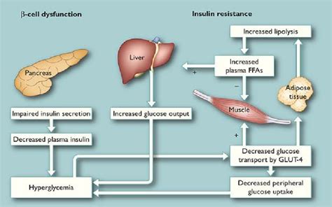 Defects in the pancreas and target tissues for insulin action in type 2... | Download Scientific ...