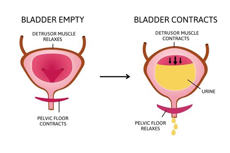 Pelvic Floor Dysfunction - AARE UROCARE - Female Urology | Urinary ...