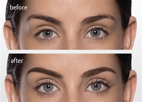 Eyelash Lift – Timeless Allure