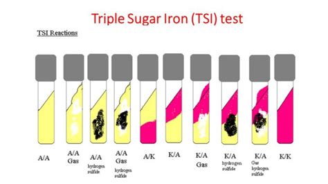 TSI (Triple Sugar Iron) test: Objective, Principle, Procedure and ...