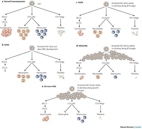 17 Best images about Myelodysplastic Syndrome (MDS) on Pinterest ...