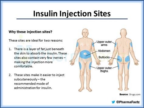 amudu: Insulin Injection Sites