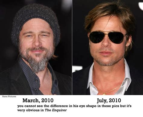 Brad Pitt Botox and Facial Fillers Plastic Surgery Before and After