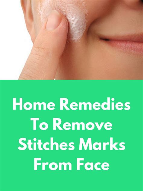 Home Remedies To Remove Stitches Marks From Face. Accidents, surgical ...