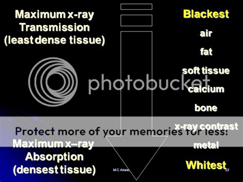 chest radiography interpretation