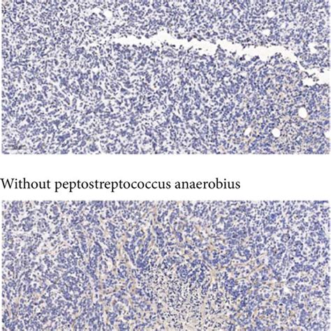 The effect of Peptostreptococcus anaerobius upon tube formation for ...