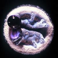 Streptomyces - microbewiki