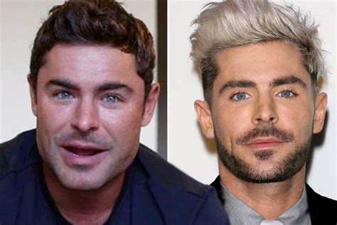 Zac Efron's fans suspect he got plastic surgery as his face looks 'totally different' in Bill ...