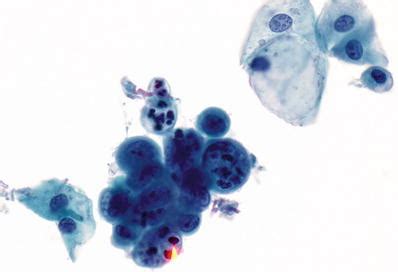 Cytopathology | Basicmedical Key