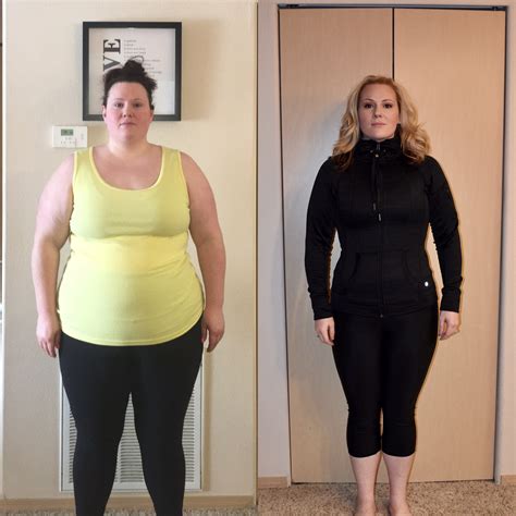 Real Weight Loss Success Stories: Andrea's 126 Pound Weight Loss Transformation