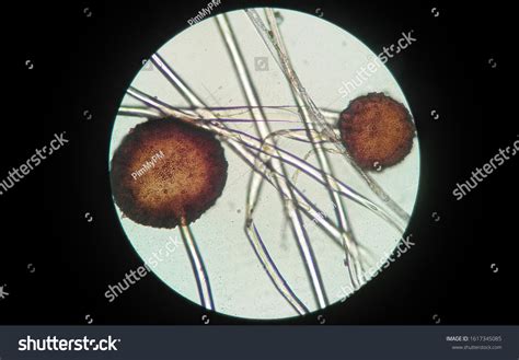 Rhizopus Oligosporus Microscope