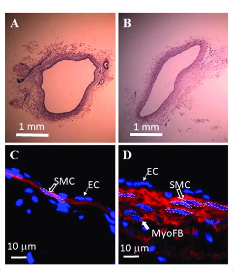 Histological analysis of swine thoracic duct for control and 28 days ...