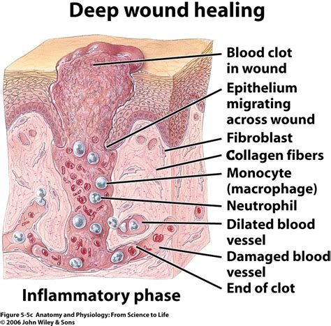 Skin: Histology and Physiology of Wound Healing - Clinics in Plastic Surgery