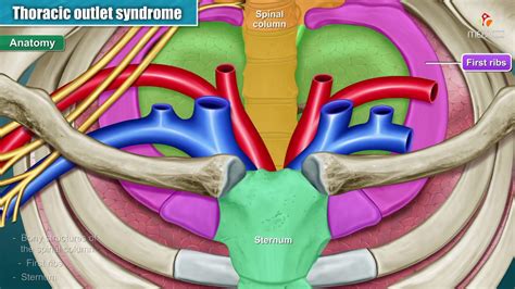 Thoracic outlet syndrome ( Part-1 ) Animation : Introduction , Anatomy , Types , Causes and ...