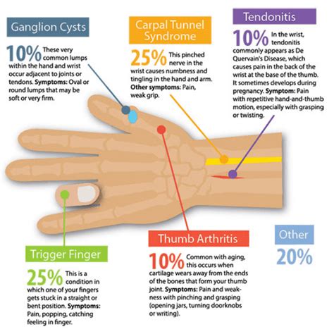 Hand Pain Chart - Varicolored Download Printable PDF | Templateroller