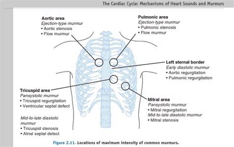 Pathophysiology of Heart Disease | Family nurse practitioner, Cardiac ...