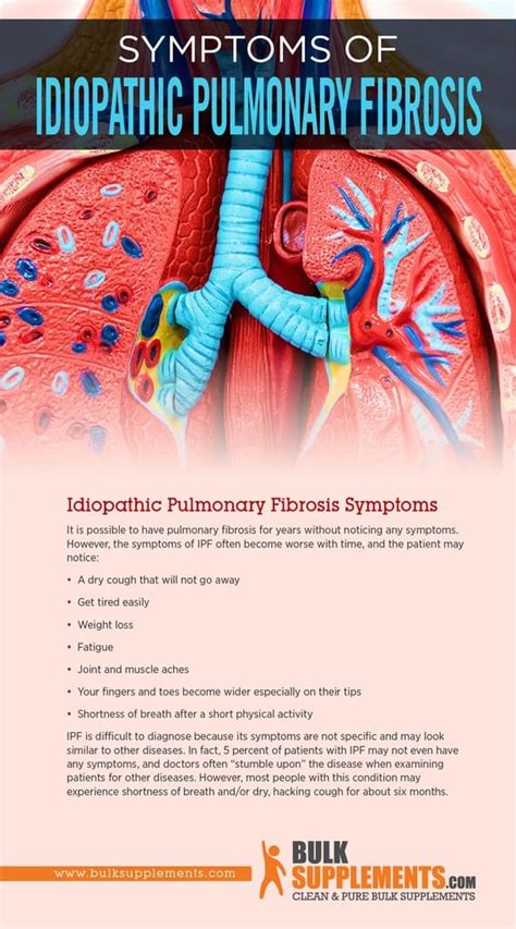 Idiopathic Pulmonary Fibrosis: Symptoms, Causes & Treatment