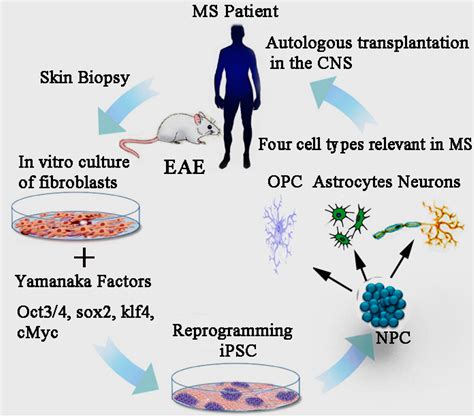 IJMS | Free Full-Text | Mesenchymal Stem Cells and Induced Pluripotent Stem Cells as Therapies ...