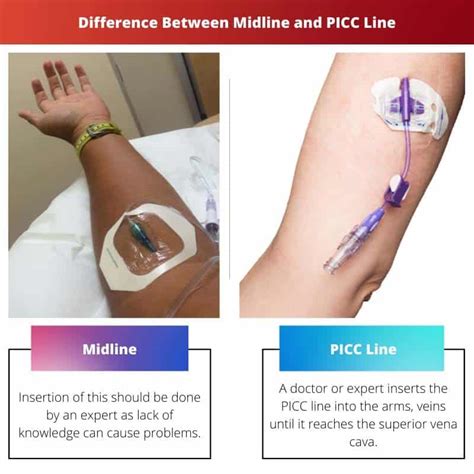 Midline vs PICC Line: Difference and Comparison