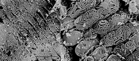 Giant Mitochondria in the Myocardium of a Patient With Mitochondrial ...