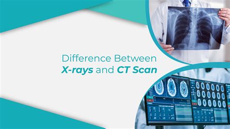 Difference between X-rays and CT scans | Dr. Remedies Labs