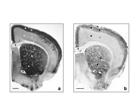 Low power photomicrographs of the distribution of calbindin in mouse ...