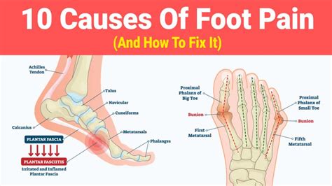 10 Causes Of Foot Pain (And How To Fix It)