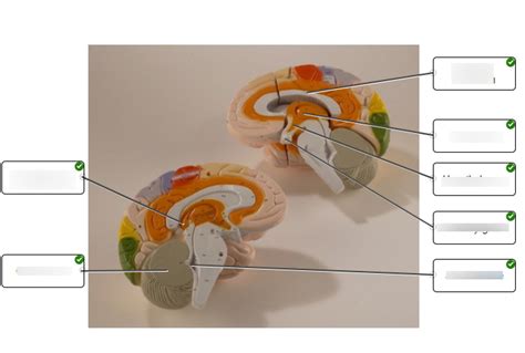 Identify the structures this midsagittal view of a brain model. Diagram ...