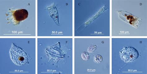 Protozoa Under Microscope