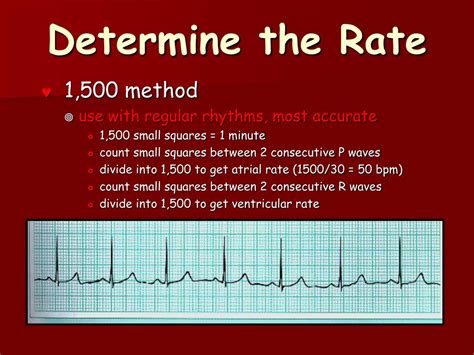 Ekg Heart Rate Calculator