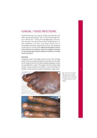 Common Skin Diseases in Africa Illustrated Guide 2001.pdf