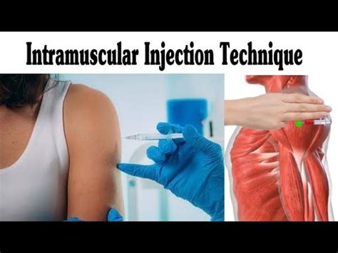 Intramuscular (IM) Injection Technique On Deltoid - YouTube