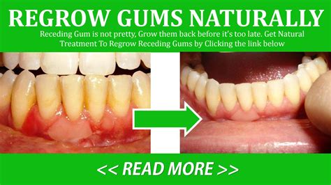 Regrow Gums by TeryHayden - Issuu