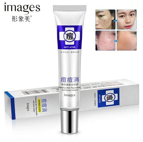 30g Images Acne Scar Remove Acne Treatment Shrink Pores Gel Bleaching ...