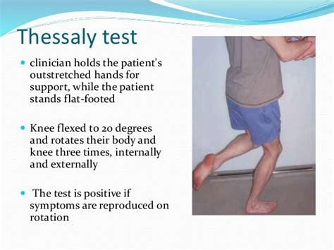 Meniscal injury