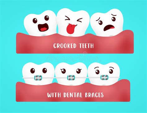 Braces Emoji Stock Illustrations – 72 Braces Emoji Stock Illustrations, Vectors & Clipart ...