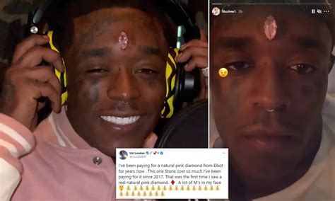 Rapper Lil Uzi Vert Gets $24 Million Pink Diamond Implanted Into His Forehead - Dimplify
