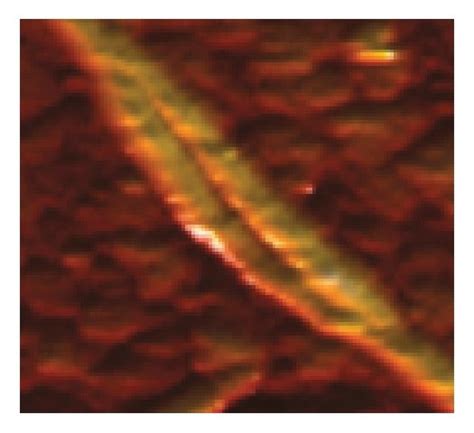 Distinctive shapes of various amyloid fibrils. (a) globular and... | Download Scientific Diagram