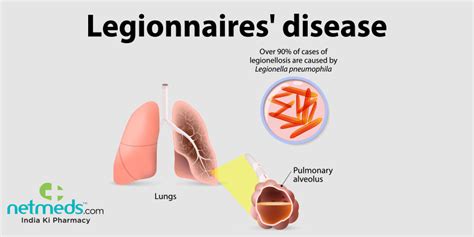 Legionnaires' Disease: Causes, Symptoms And Treatment