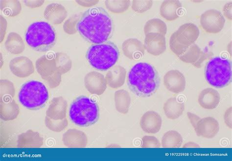 Lymphocyte Cells In Blood Smear Stock Image | CartoonDealer.com #126098983