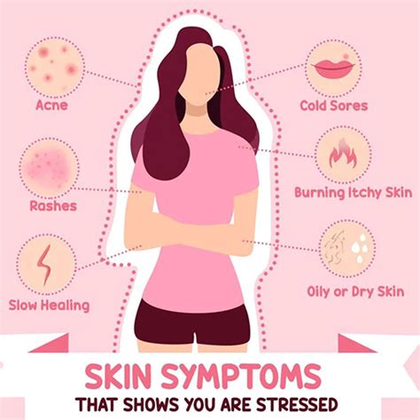 How to Deal with Stressed Skin - Eshaistic Blog