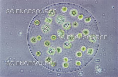 Eudorina Under Microscope