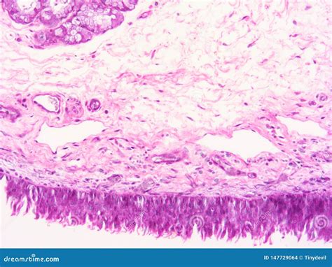 Histology Of Epiglottis Human Tissue Stock Photography | CartoonDealer.com #147728648