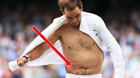 Wimbledon 2022 - Rafael Nadal has 7mm abdominal tear ahead of Nick ...