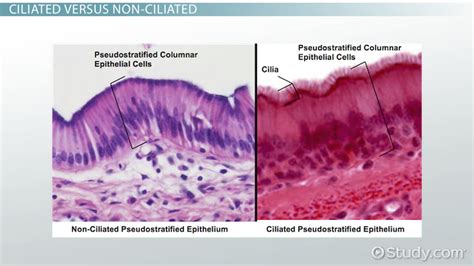 Pseudostratified Columnar Epithelium Location Types Function | My XXX ...