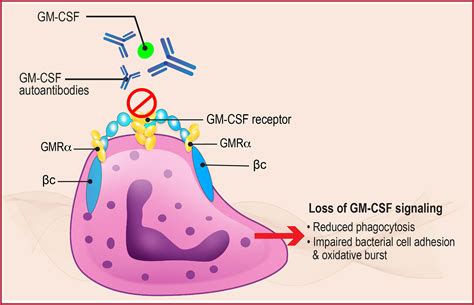 Frontiers | The Role of GM-CSF Autoantibodies in Infection and ...