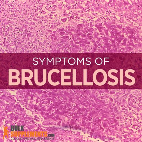 Brucellosis: Symptoms, Causes & Treatment