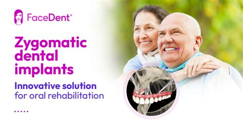 Dental implants: zygomatic vs. conventional - FaceDent